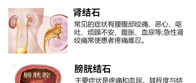 钬激光