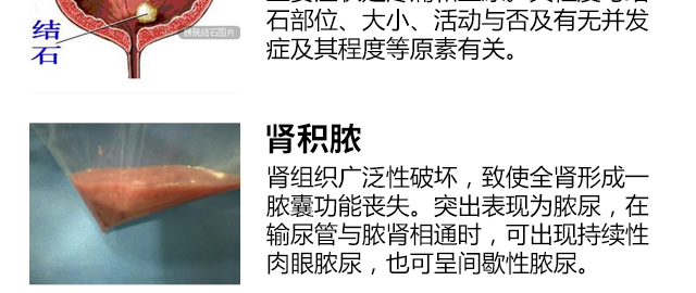 钬激光