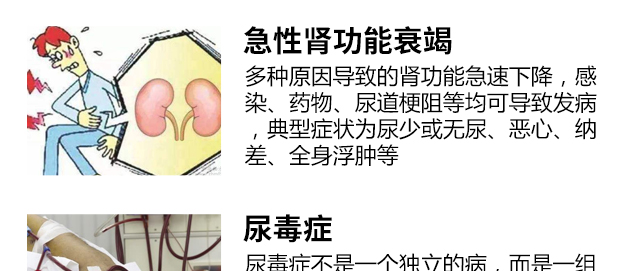 钬激光