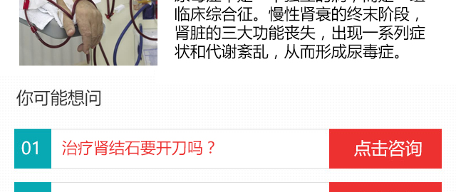 钬激光