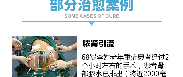 钬激光